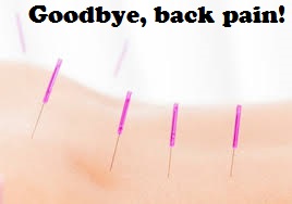 acupuncture for pain