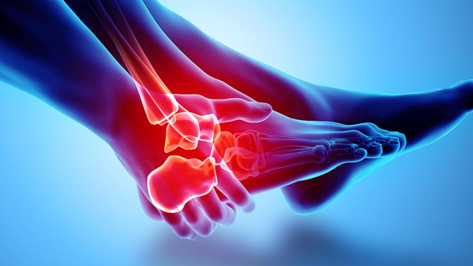 ankle pain