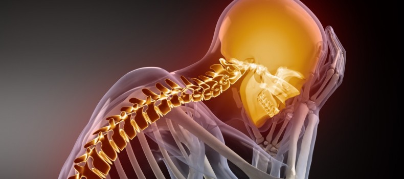 cervicalgia headache