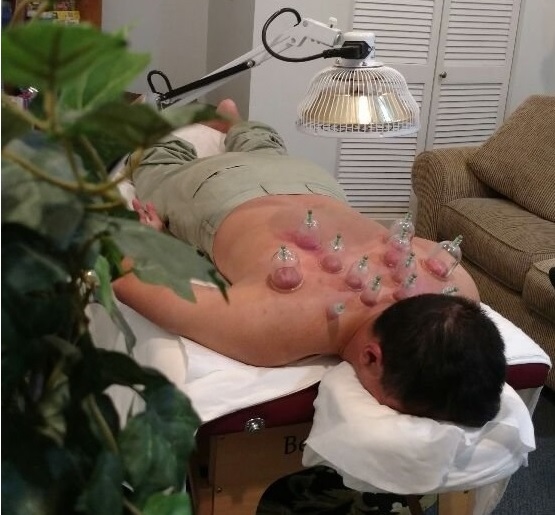 acupuncture for pain